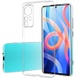 TPU чехол Epic Transparent 1,5mm Full Camera для Xiaomi 12 / 12X Бесцветный (прозрачный)